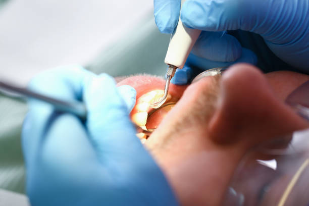 Best Emergency Broken Tooth Repair in West Baraboo, WI